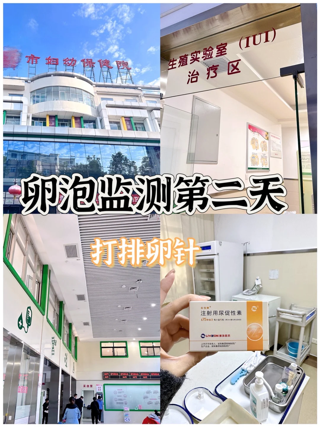 卵泡监测｜医院监测卵泡之【排卵针】初体验,国内助孕热线，代孕机构名称