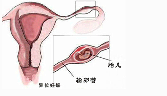 移植知识学习笔记—配型,代孕包成功费用多少_代孕精子卵子谁提供